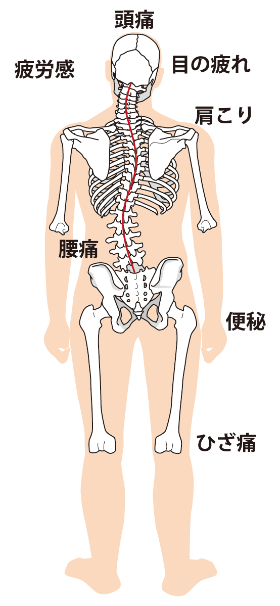 高崎市腰痛整体、左半身が調子悪い、左側の痛みや不調が起きる